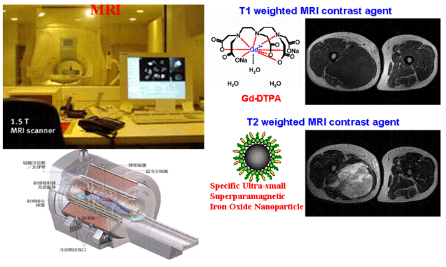 1523MRI